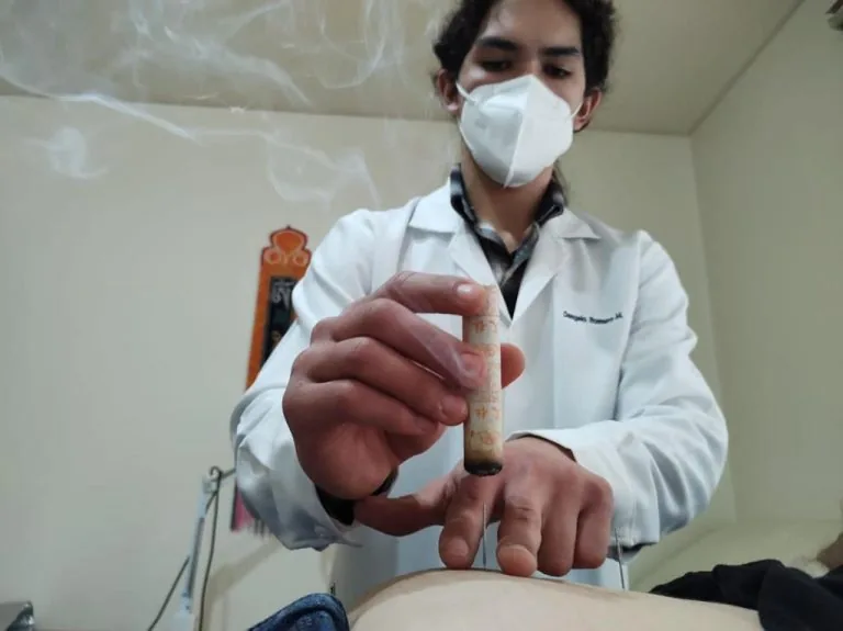 Alumno sosteniendo un puro de moxa encendido, listo para una aplicación de moxibustión.